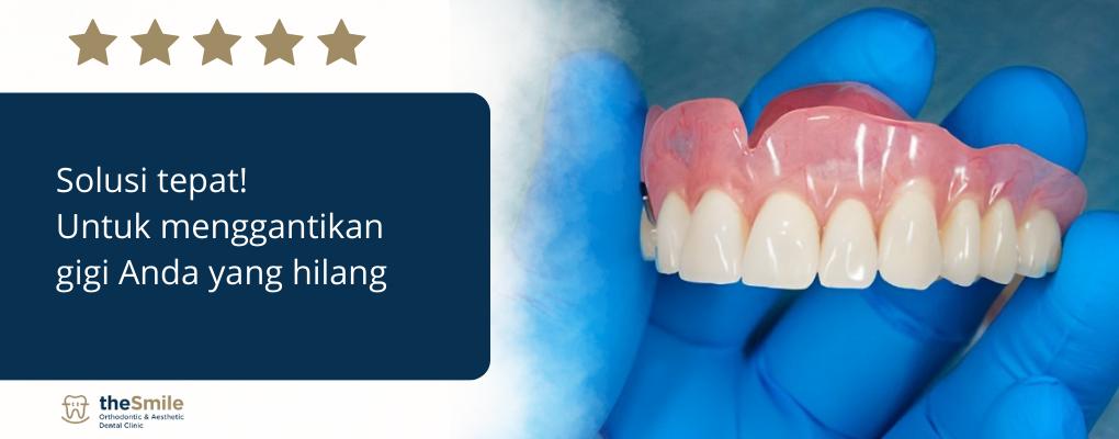 pasang gigi palsu