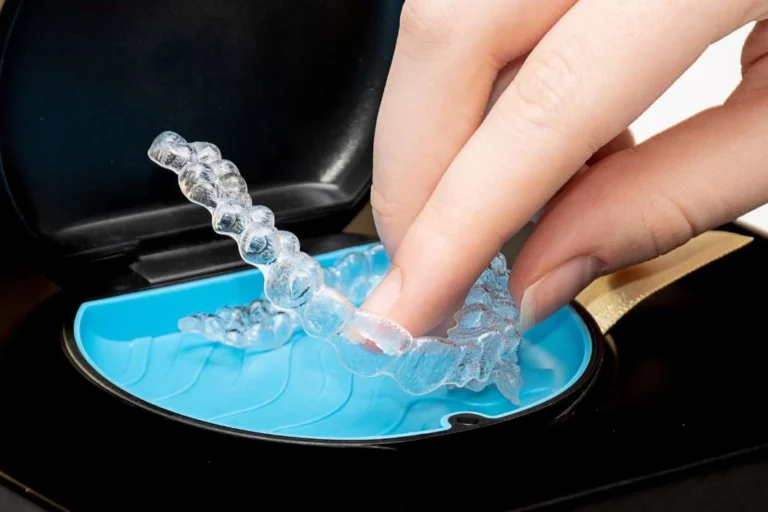 Invisalign adalah salah satu inovasi terbaru dalam perawatan ortodonti.