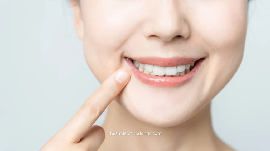 Aesthetic Dental Care atau perawatan gigi estetika adalah rangkaian prosedur yang difokuskan pada penampilan gigi dan senyum, bukan hanya kesehatan gigi semata.