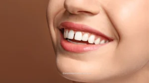 foto overbite pada wanita