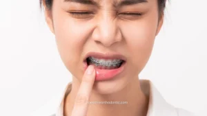 cara mengatasi sakit behel pada gigi