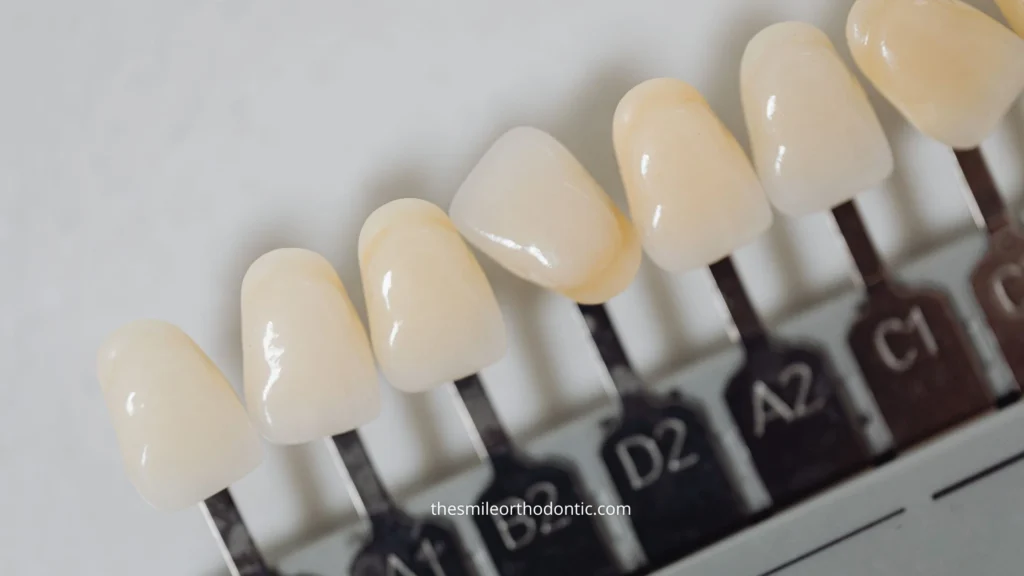 Cari tahu kisaran harga veneer gigi per gigi, faktor yang memengaruhi biaya, perbedaan composite dan porcelain veneer, serta hal yang perlu diperiksa sebelum veneer.